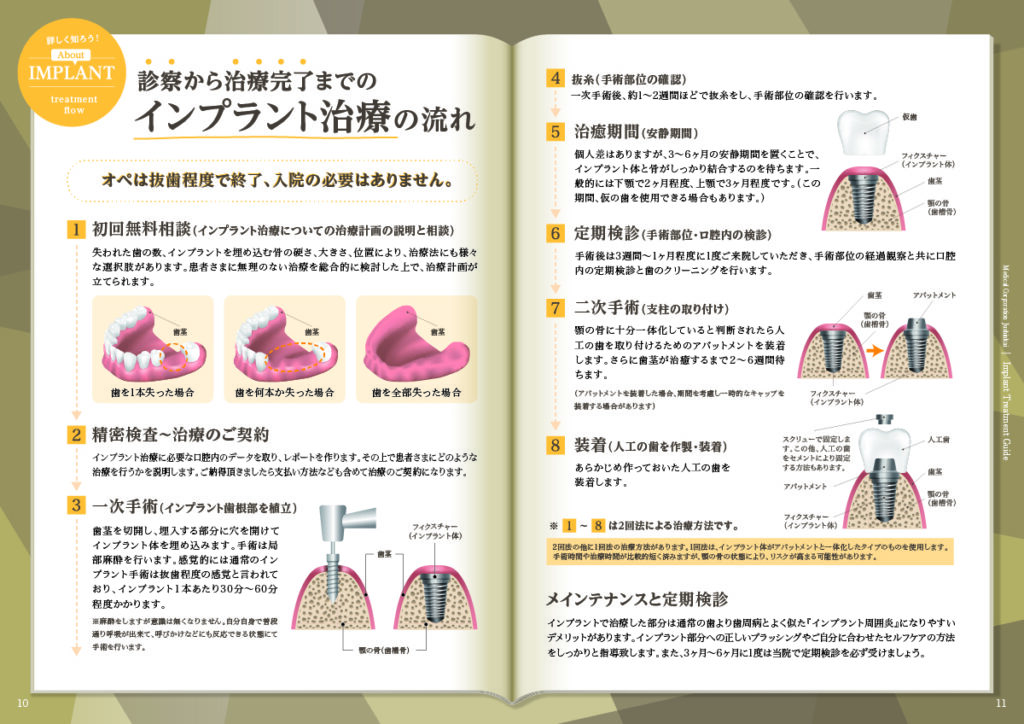 インプラントパンフレット