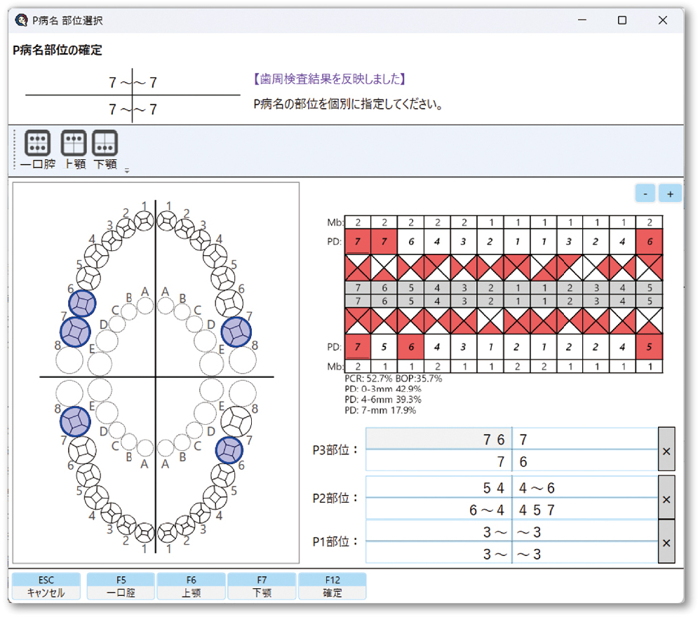 歯科衛生士の自律性を高める「DH業務サポート機能」｜QWERTY カルテ