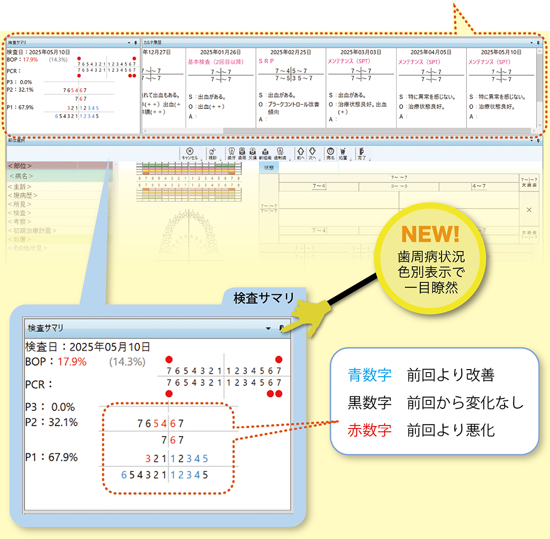 診療の質を均一化する「SOAP形式」と「Progress View」｜QWERTY カルテ
